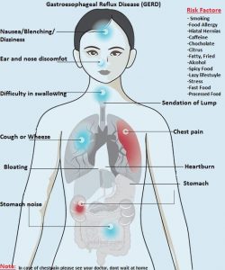 Gastroesophageal Reflux Disease Symptoms Causes Treatment
